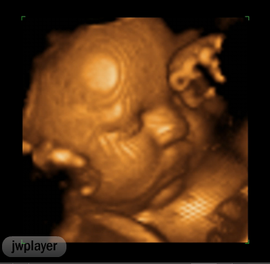 Baby Ultrasound PNG - 164121