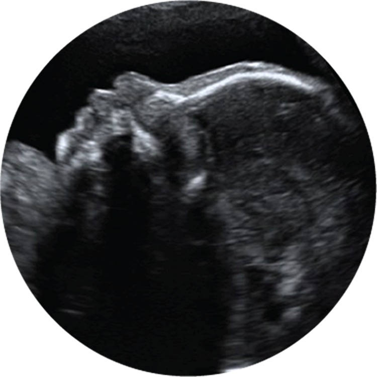 Baby Ultrasound PNG - 164118