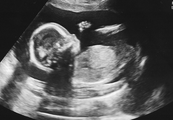 Ultrasound Image Fetus Icon, 