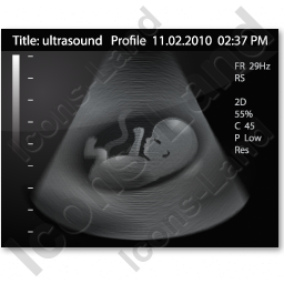 Baby Ultrasound PNG - 164120