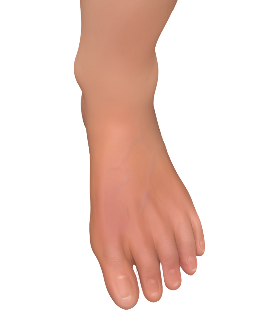 Foot and Toe Fractures