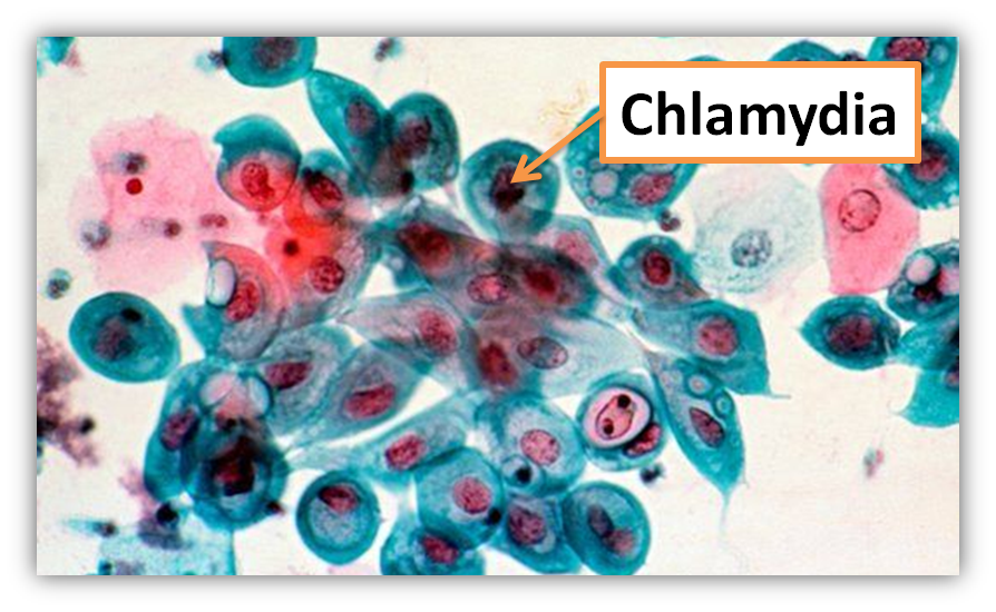Chlamydia PNG HD - 144327