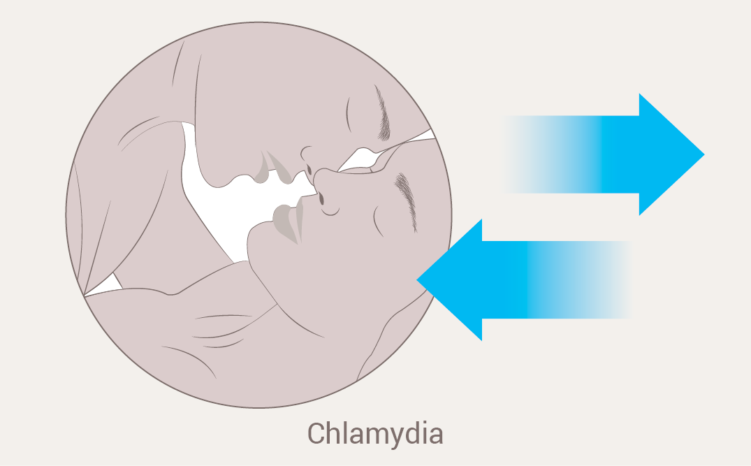 Chlamydia PNG HD - 144319