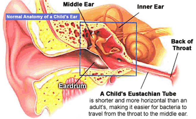 Ear Infection PNG - 170532