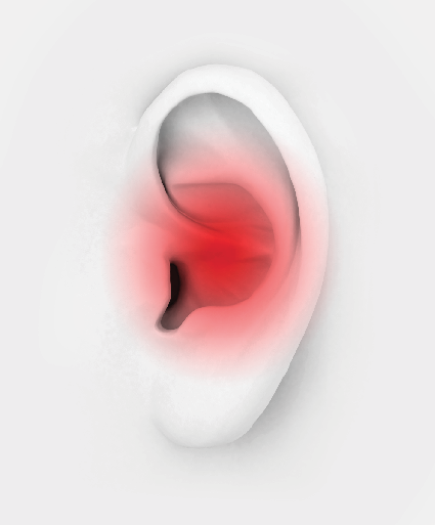 Ear Infection PNG - 170527
