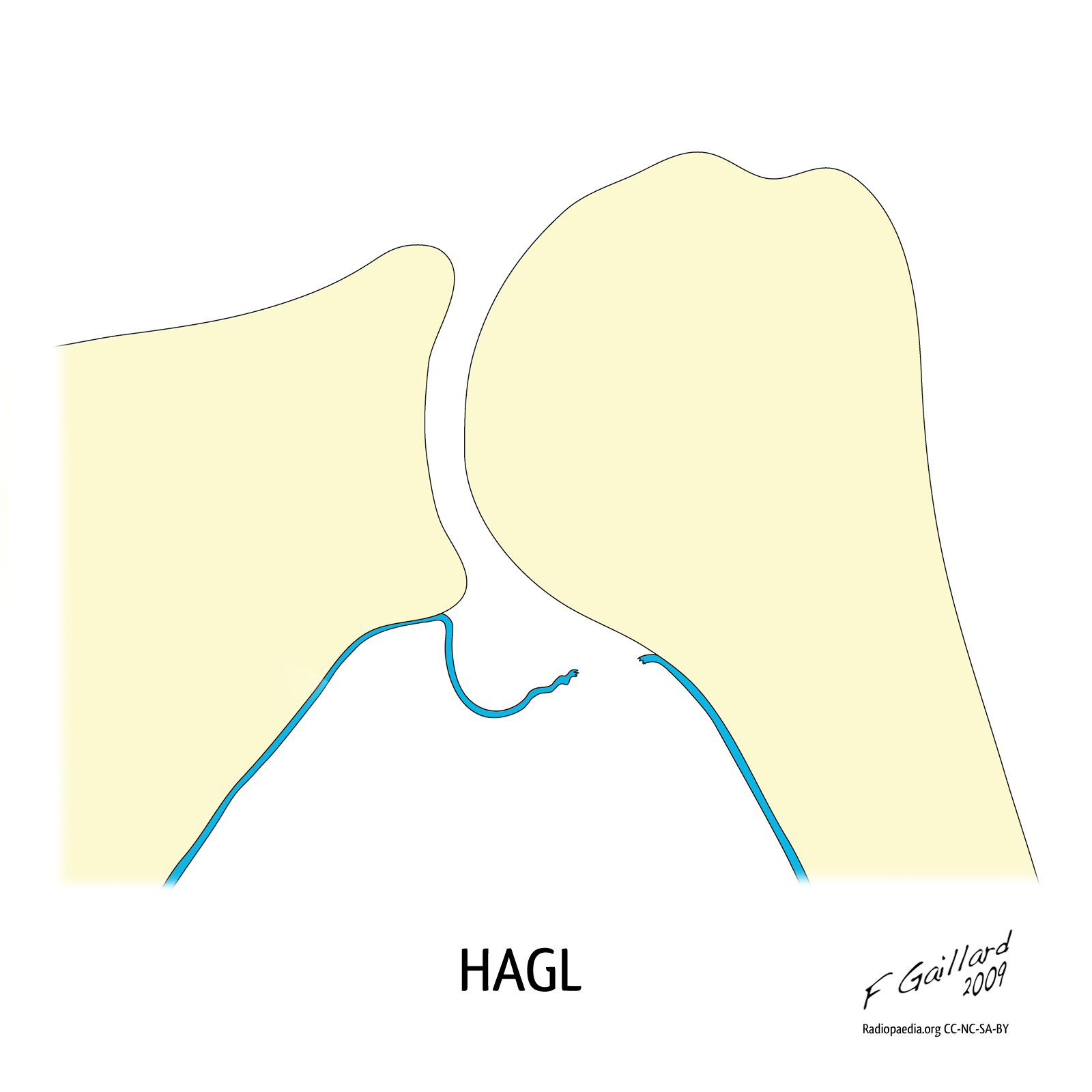 Hagl PNG - 111941
