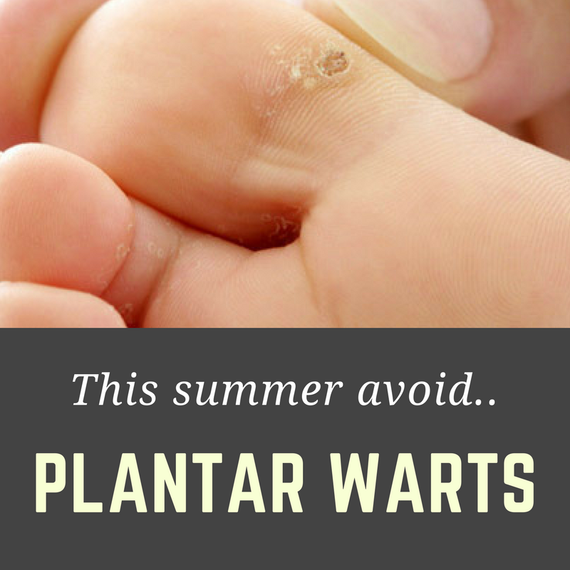 Planters Wart PNG - 164691