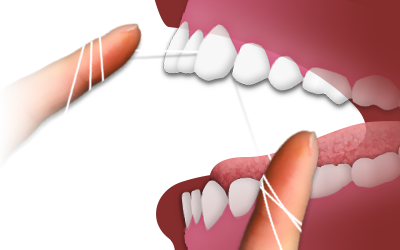 PNG Dental Floss - 139894