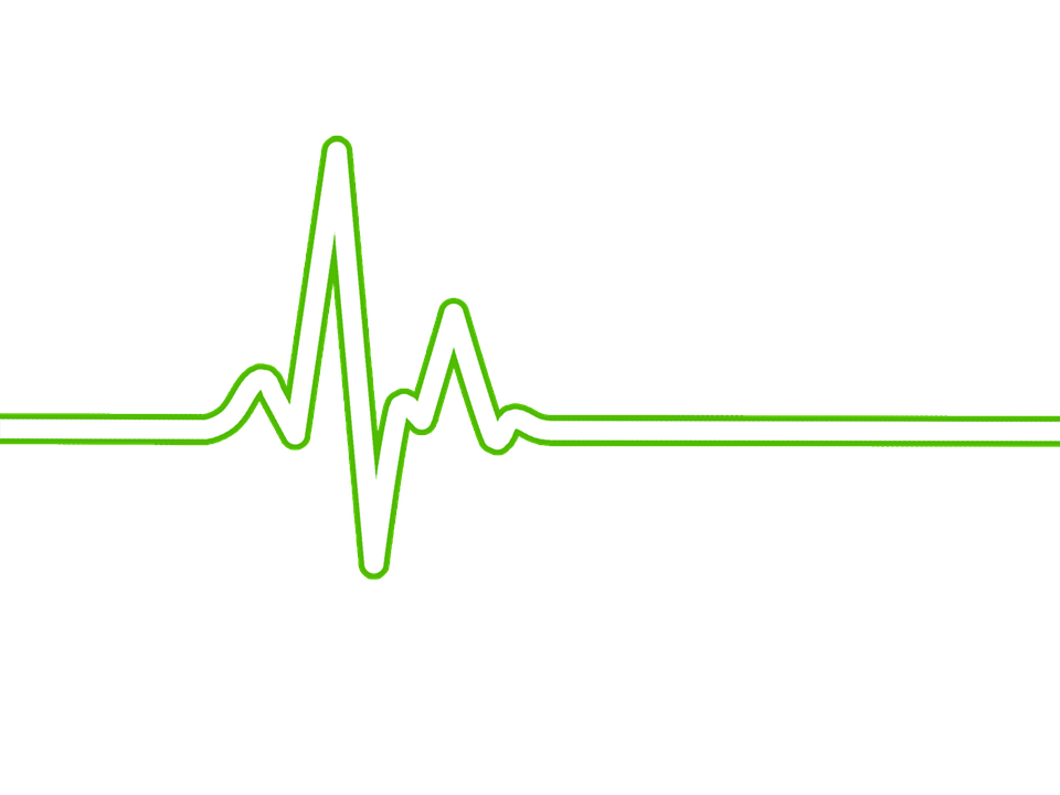 An electrocardiogram (EKG) is