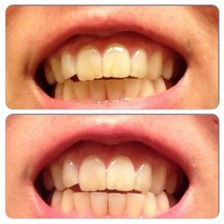 PNG HD Teeth Smile - 121478