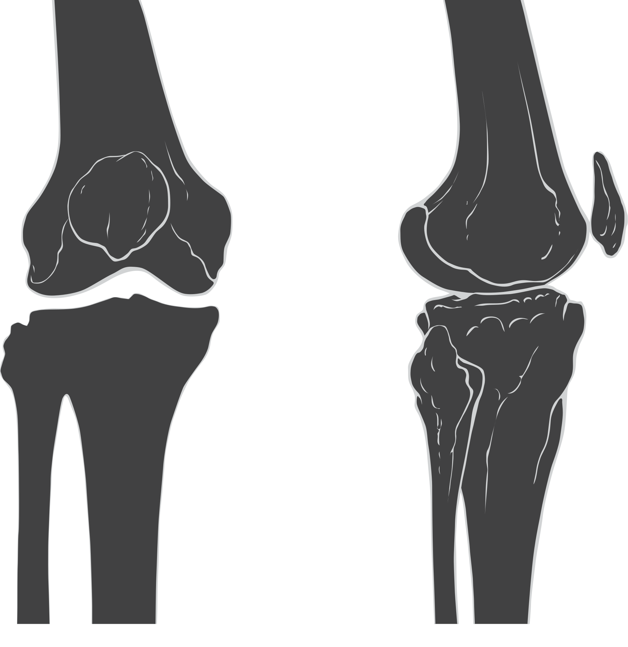 Knee Pain u0026 Injuries