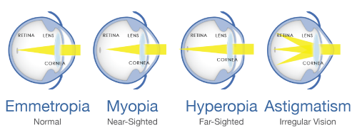 Identified Myopia Loci as App