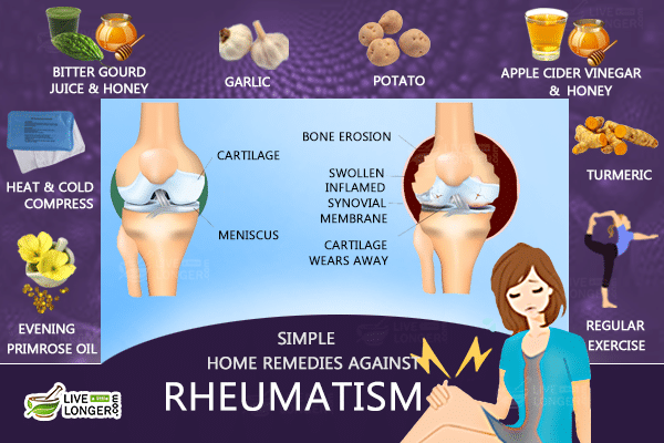 Rheumatism PNG - 76194