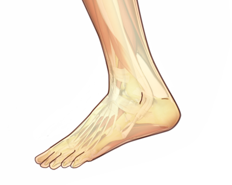 Sprained Ankle PNG - 64501