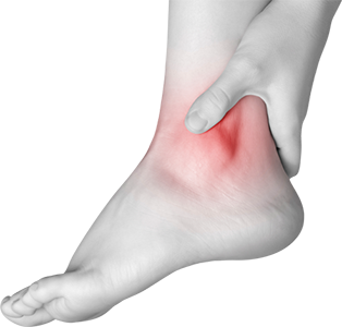 Sprained Ankle PNG - 64497