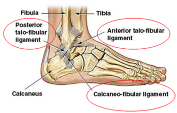 Sprained Ankle PNG - 64505