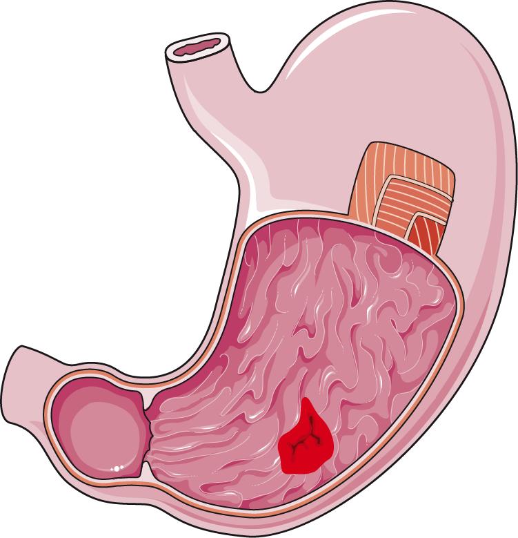 Stomach PNG HD - 128982