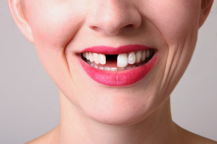 Tooth Gap PNG - 132616