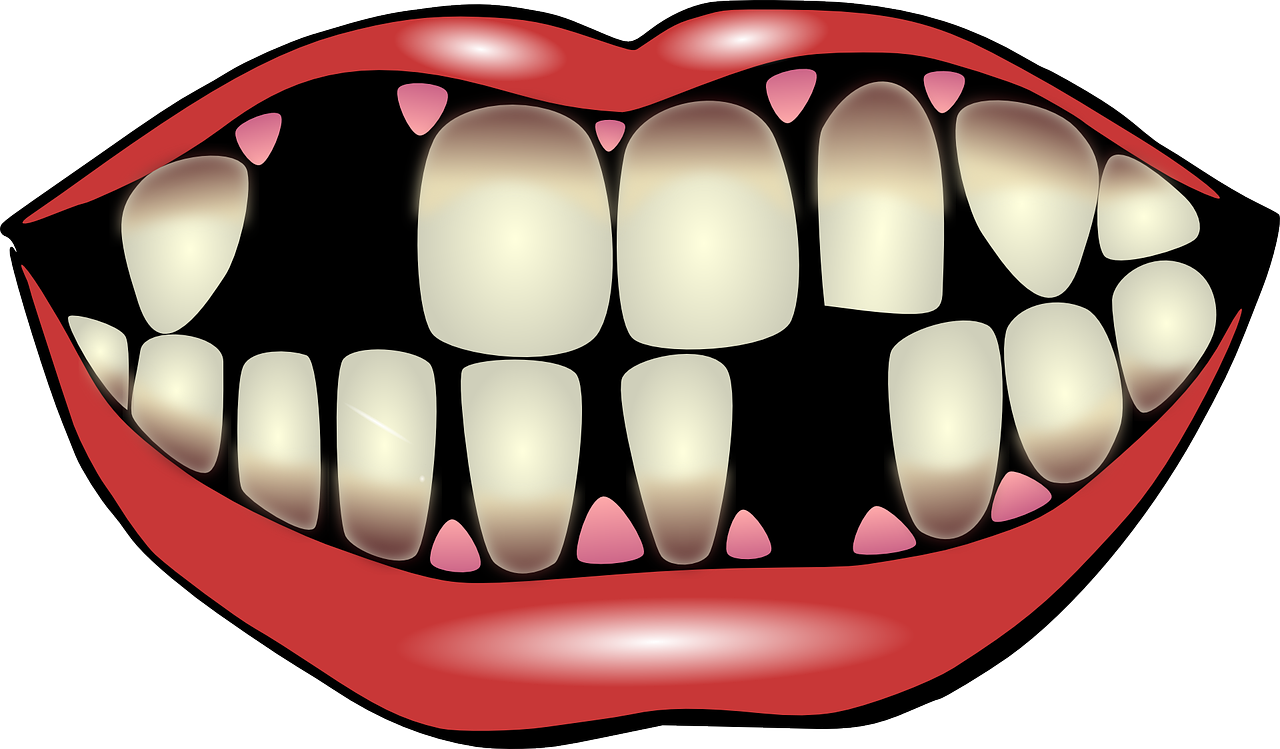 Collection of Tooth Gap PNG.